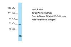 URB/CCD80 Rabbit anti-Human, Polyclonal, Novus Biologicals 0.1ml; Unconjugated:Antibodies,